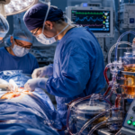 What Is HIPEC Surgery and How Does It Treat Ovarian Cancer ?